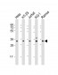 SPPL2B Antibody (N-Term)
